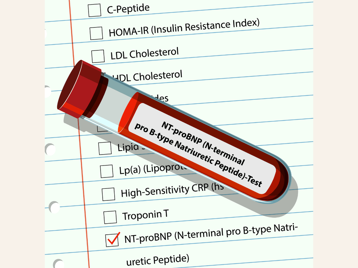 Lab test